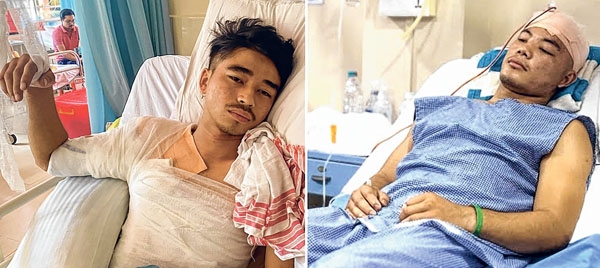 Manipur মণিপুর ৩০শে সেপ্টেম্বর ২০২৩ঃ মণিপুরে ছাত্রদের ওপর ‘পেলেট বন্দুক’ প্রয়োগ, মণিপুরের সহিংসতায় 58 জন মিতেই নিহত এবং 23 নিখোঁজ, সিউলে মণিপুরের নারকো-সন্ত্রাস নিয়ে প্রতিবাদ,  ছাত্র হত্যায় নাগা স্টুডেন্টস অ্যাসোসিয়েশের ধিক্কার, কুকি জঙ্গিরা আক্রমণ চালিয়ে যাচ্ছে