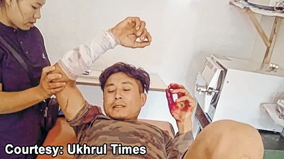 front photo front photo